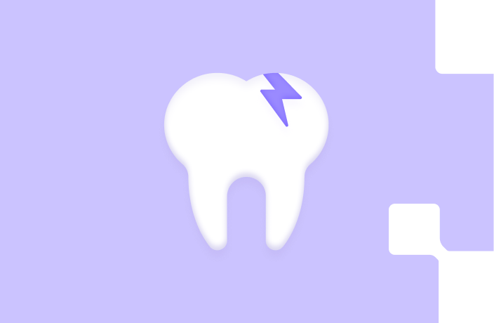 Dental bonding