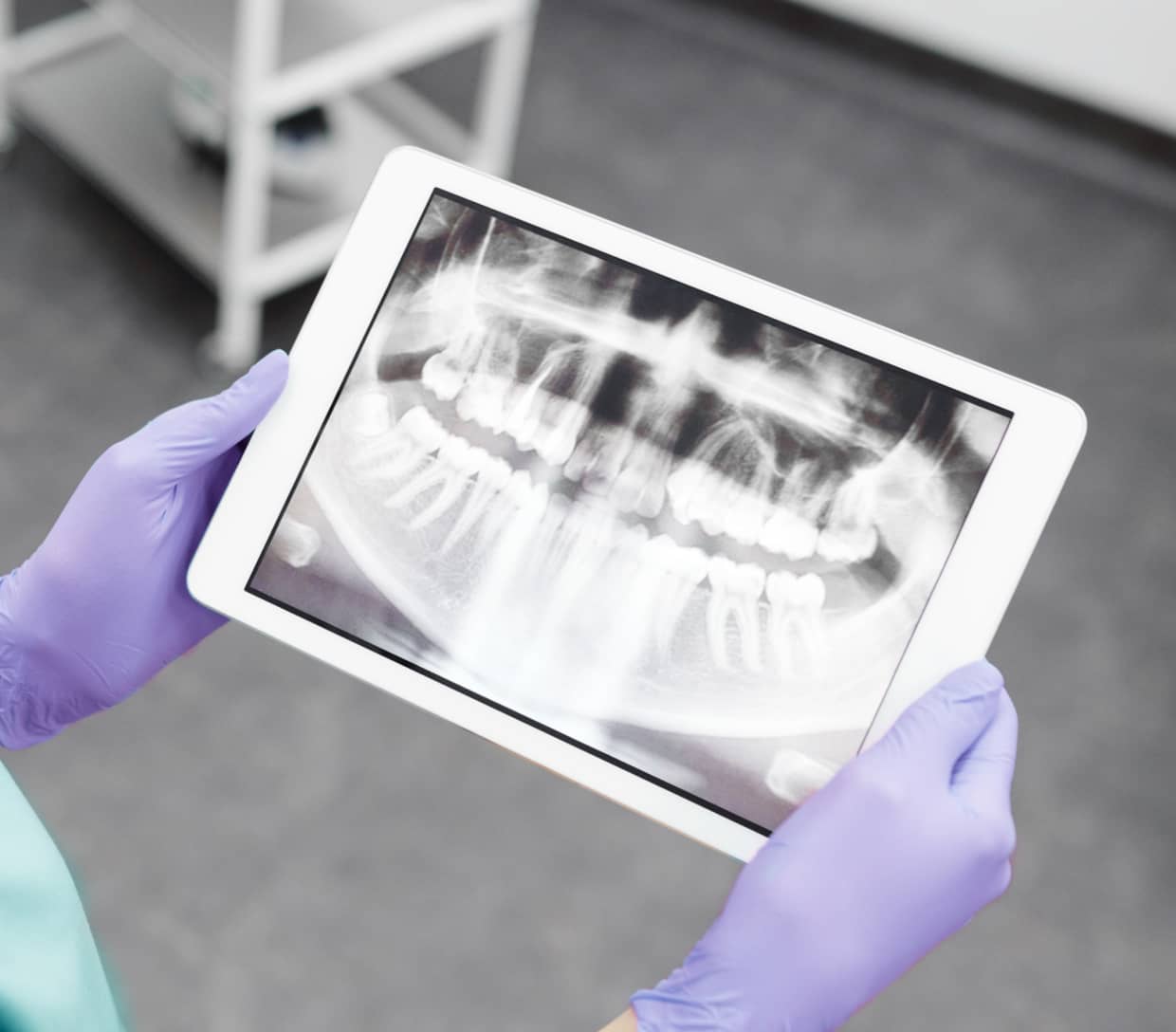 Pull your tooth or save it? Which is the best? 