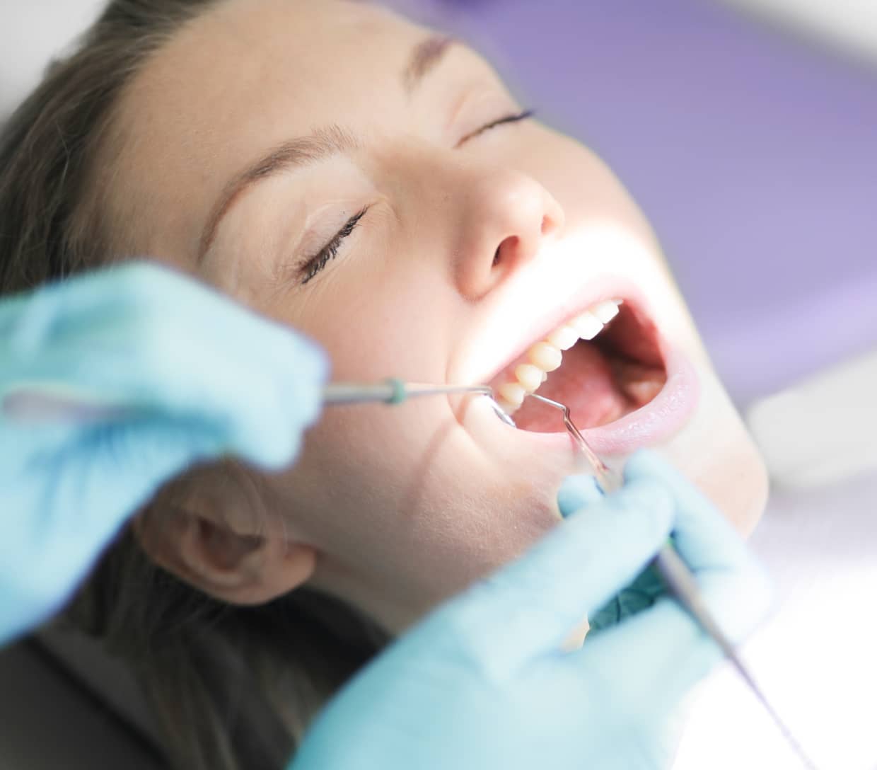 Does wisdom teeth removal hurts? All you need to know