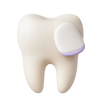 Porcelain Veneers - CIUGU